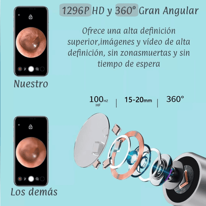 🦻ClearView Pro™ Limpiador de oídos inteligente con cámara HD