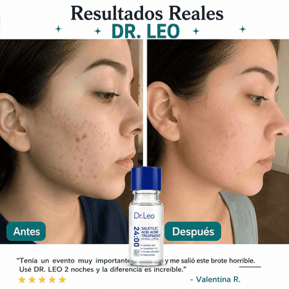 👨‍⚕️Tratamiento Antiacné de Precisión